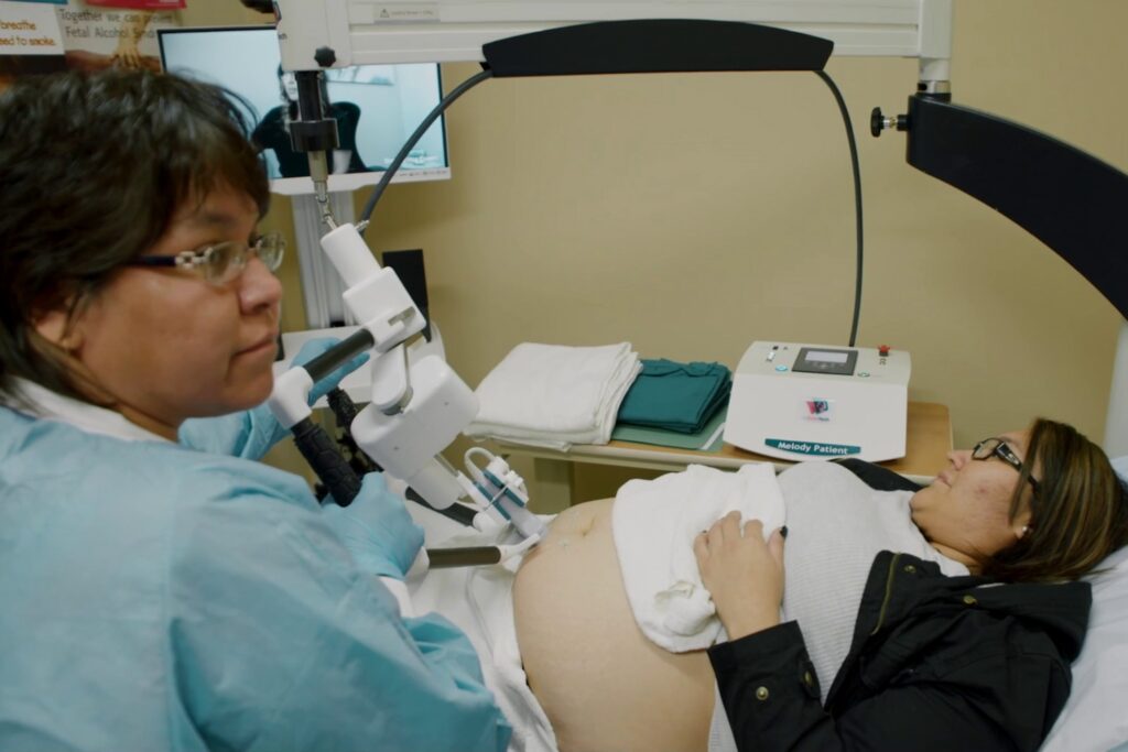 A pregnant woman is laying down for an ultra sound from a robotic ultrasound machine